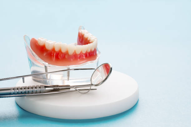Dental Inlays and Onlays in Union City, OK